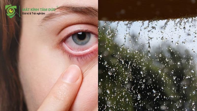 Cẩm nang chăm sóc mắt bảo vệ mắt vào mùa mưa không thể bỏ qua