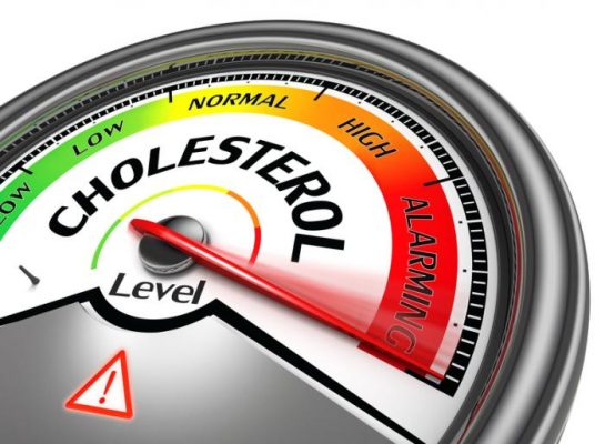 dấu hiệu của mắt về tình trạng cholesterol cao trong máu như thế nào