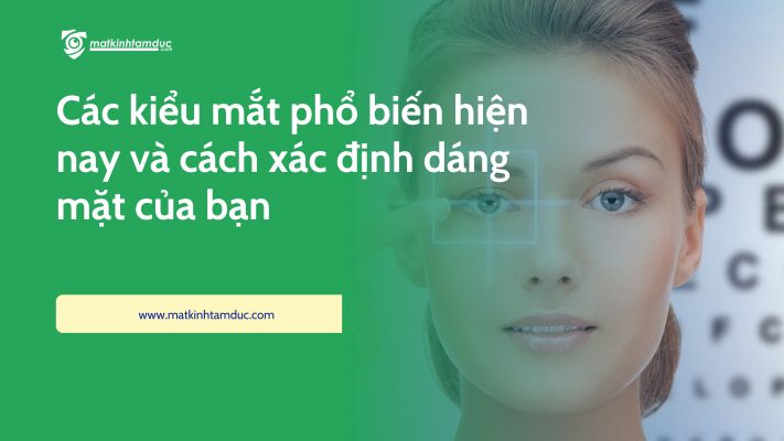 các kiểu mắt