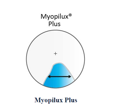 Tròng kính kiểm soát cận thị Essilor Myopilux Plus