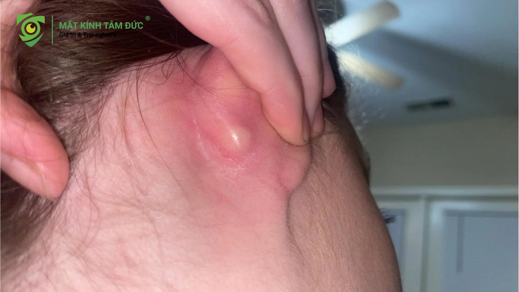 Cách đeo tai nghe chụp tai không bị đau khi đeo kính.