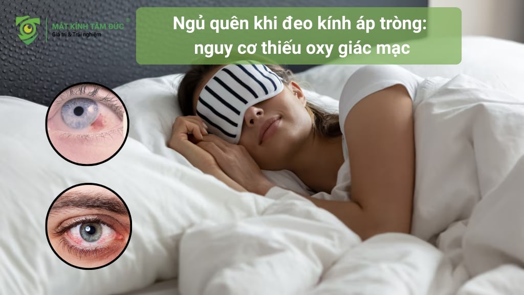 Khi bạn thức, giác mạc (phần trong suốt phía trước mắt) nhận oxy chủ yếu từ không khí. Đeo kính áp tròng, dù hiện đại đến đâu, vẫn làm giảm lượng oxy này. Khi bạn ngủ, mí mắt nhắm lại, lượng oxy cung cấp cho giác màng vốn đã thấp nay càng giảm mạnh hơn.