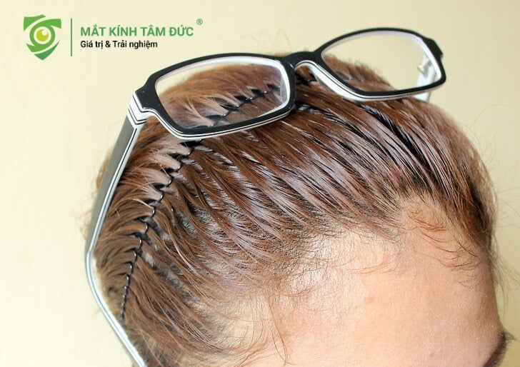 Tại sao cài kính lên đầu là cách nhanh nhất làm hỏng gọng kính?