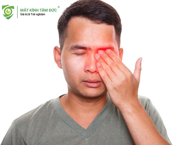 Tăng nguy cơ các bệnh lý mắt nghiêm trọng khi bị cận không đeo kính