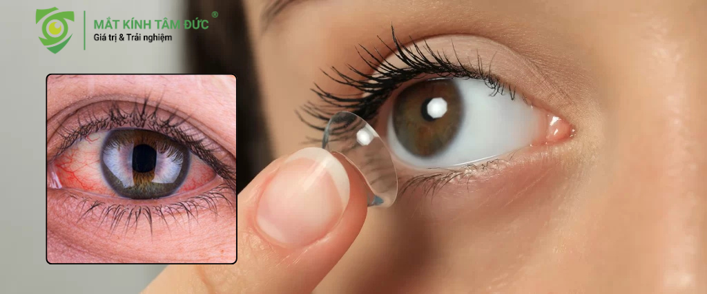 Đây là các dấu hiệu cảnh báo nghiêm trọng hơn, có thể là kích ứng đơn thuần hoặc bắt đầu của một vấn đề y tế