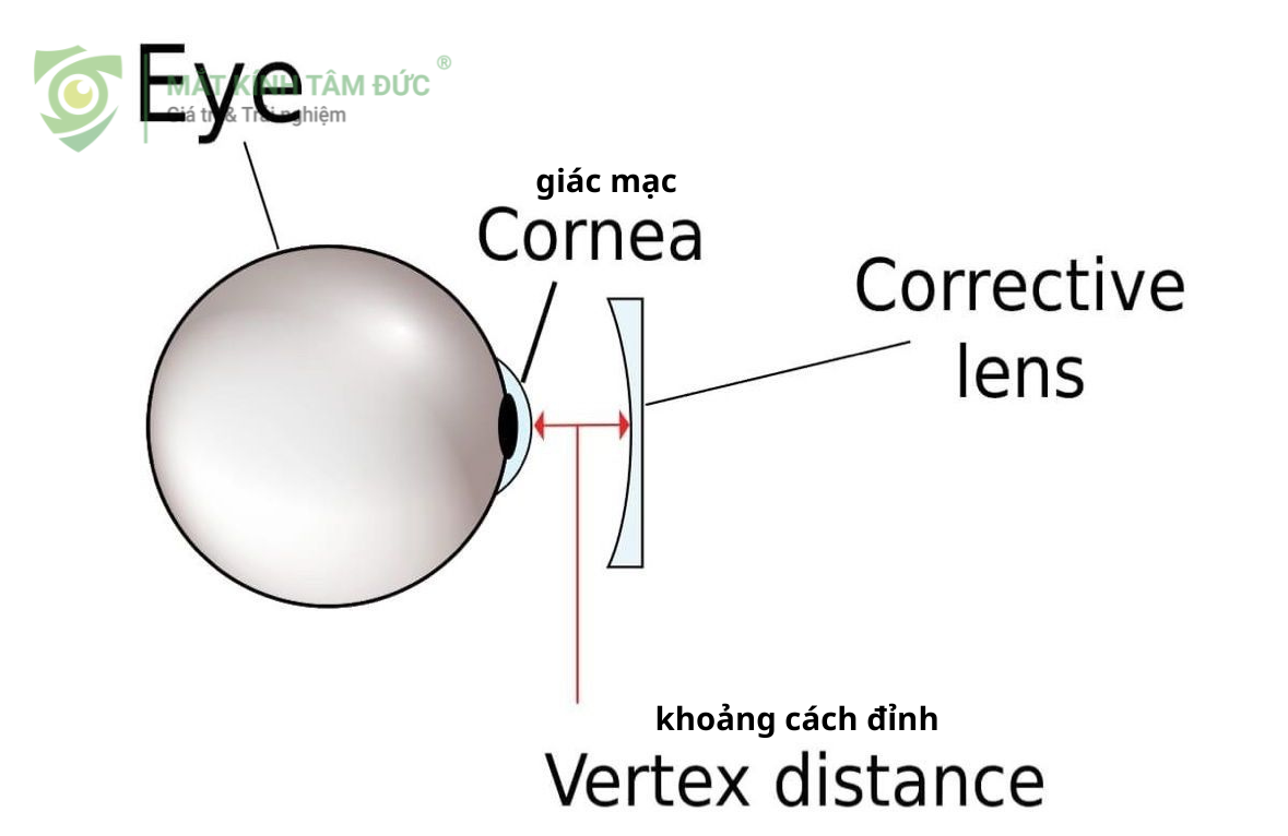 Khoảng cách đỉnh (Vertex distance) sai lệch khi dùng chung kính cận làm thay đổi độ cận thực tế mà mắt nhận được, gây nhòe hình ảnh.