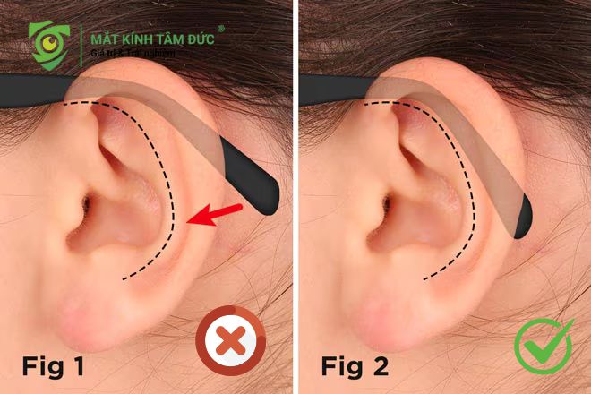 Hãy đảm bảo phần càng kính được điều chỉnh ôm vừa vặn vào vành tai Nếu cầu kính quá hẹp, nó sẽ bóp chặt vào sống mũi. Nếu quá rộng, kính liên tục trượt xuống gây khó chịu.