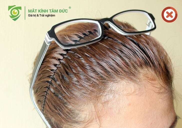 Tuyệt đối hạn chế thói quen cài kính lên đầu đây là những hậu qủa không nên dùng gọng kính cũ lắp tròng mới 