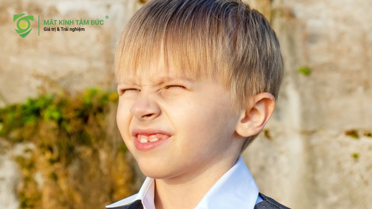 Thường xuyên nheo mắt: Đặc biệt là khi ra nắng hoặc khi phải nhìn tập trung vào màn hình