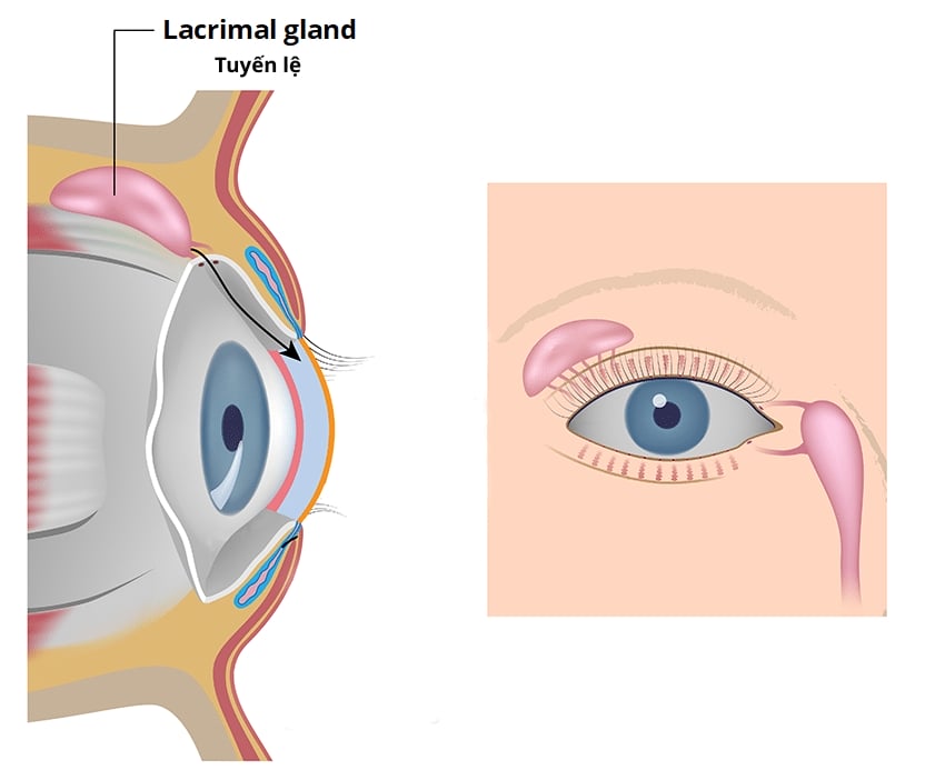tắc tuyến lệ nguyên nhân hàng đầu gây ra tình trạng chảy nước mắt sống cơ học.