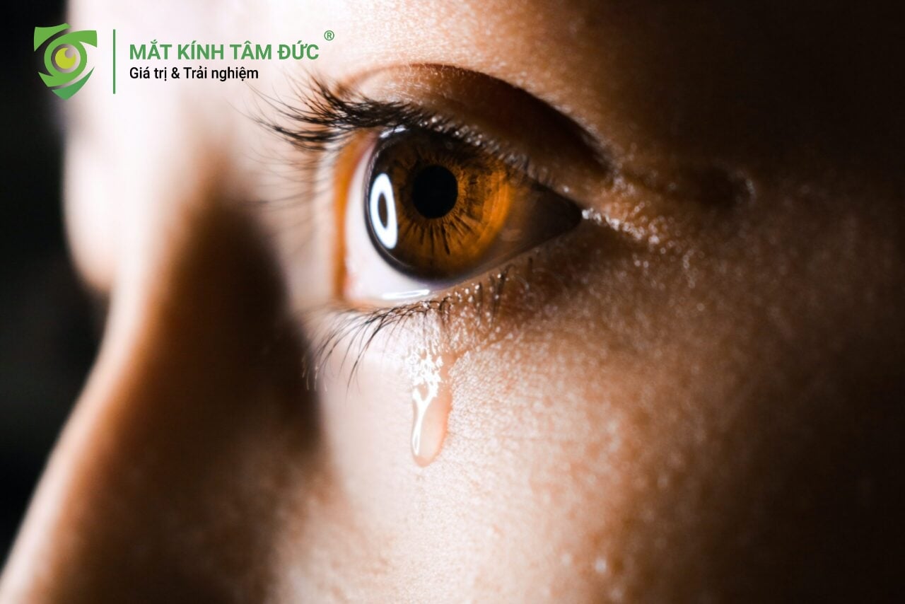 Chảy nước mắt sống là bệnh gì? Nguyên nhân và cách điều trị dứt điểm