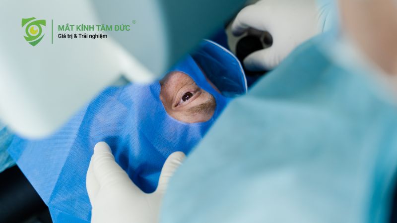 Loạn thị có cần đeo kính không và cách chọn kính phù hợp