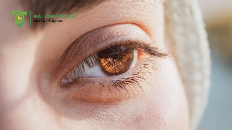 Mắt cận 10 độ có mổ được không? Ai đủ điều kiện và ai không nên mổ