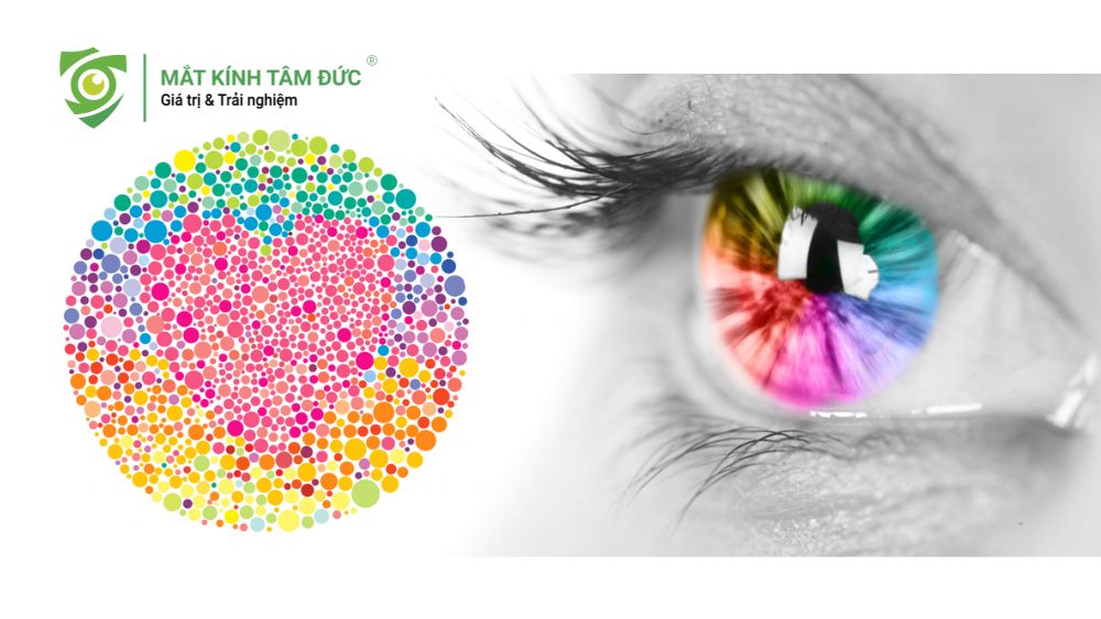 Rối loạn thị giác là gì? Mù màu thường mang yếu tố di truyền và phổ biến hơn ở nam giới bị rối loạn thị giác