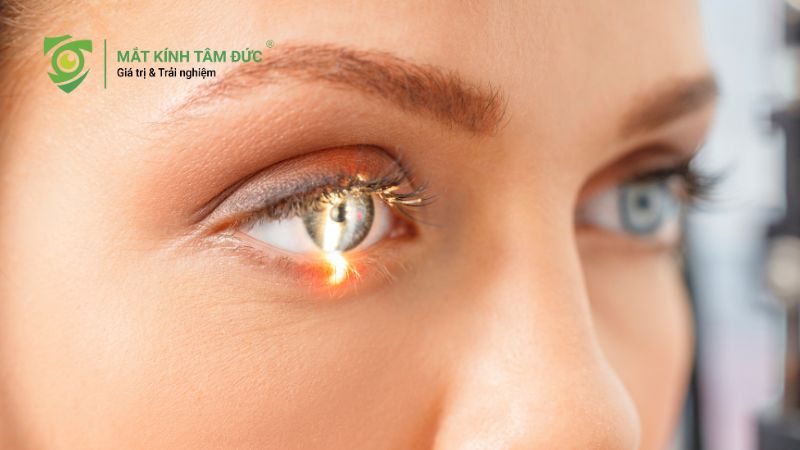 Đồng tử là gì? Vai trò và cách bảo vệ đồng tử khỏe mạnh