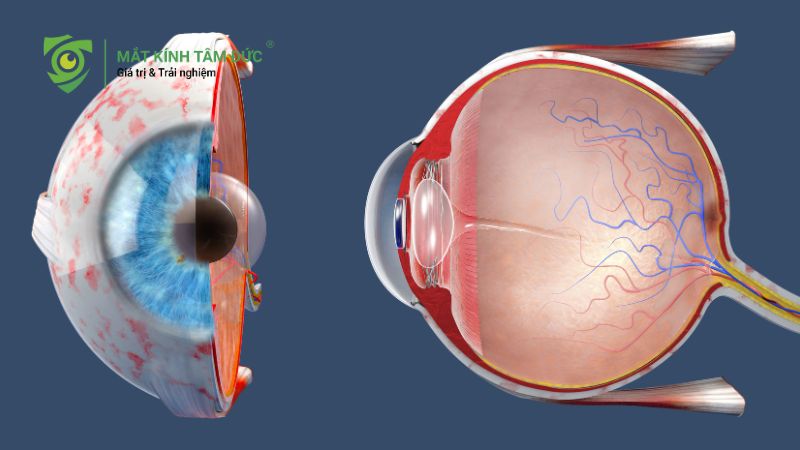 Giác mạc là gì? Vì sao giác mạc ảnh hưởng trực tiếp đến thị lực?