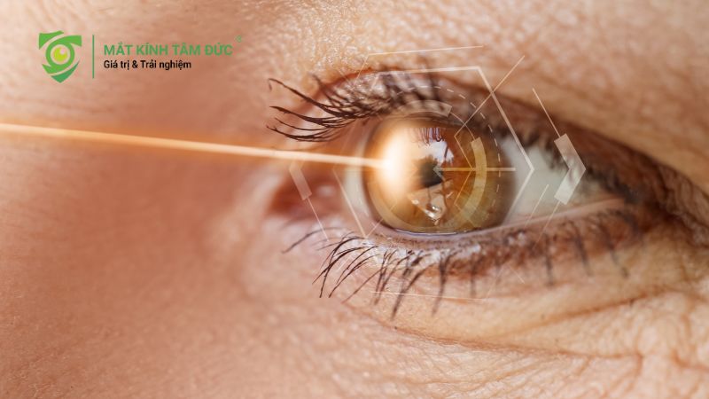 Giác mạc là gì? Vì sao giác mạc ảnh hưởng trực tiếp đến thị lực?