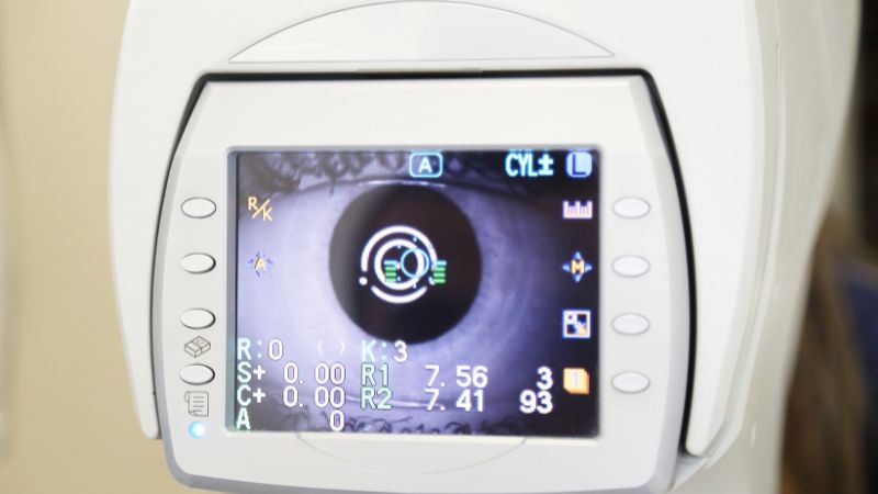 Mắt nhìn thấy gợn sóng là gì? Nguyên nhân và cách điều trị