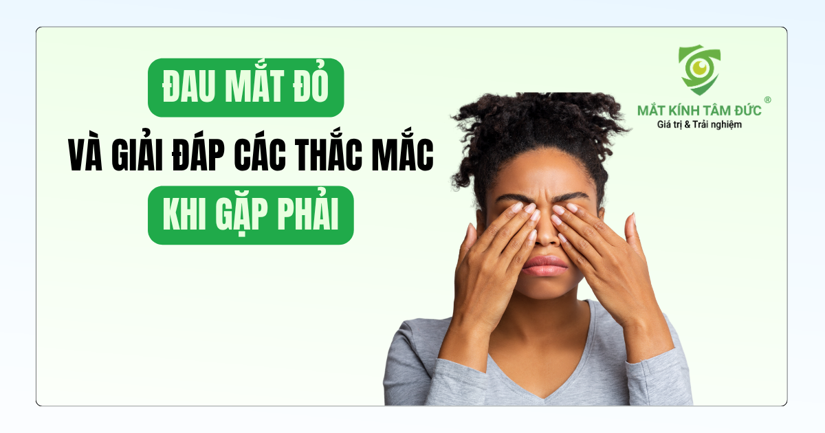 Đau mắt đỏ và giải đáp 6 thắc mắc cần biết khi gặp phải