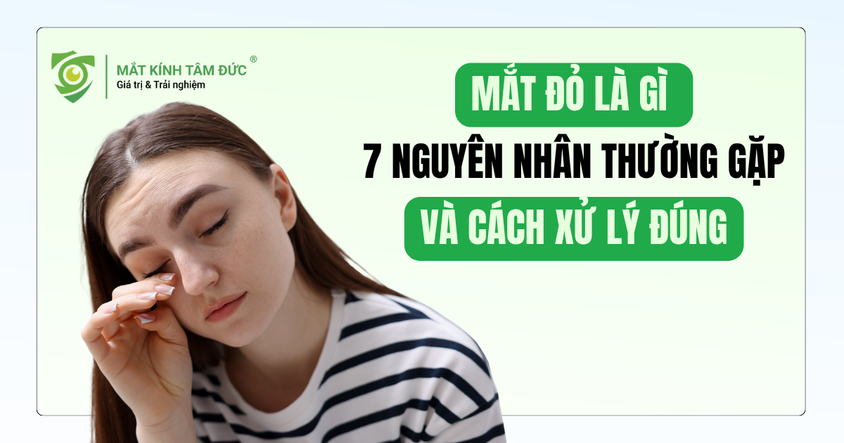Mắt đỏ là gì? 7 nguyên nhân thường gặp và cách xử lý đúng