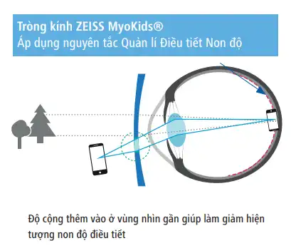ZEISS MyoKids hoạt động như thế nào?